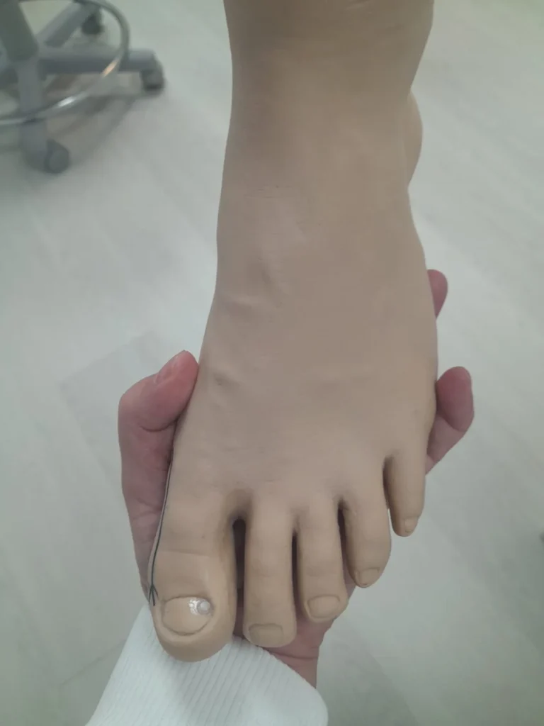 clinica de podologia em Joinville Iza Pinz cuidados com os pés saude podologa (5)