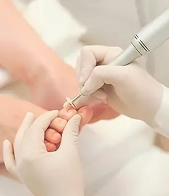 podologia em Joinville podologa calosidades