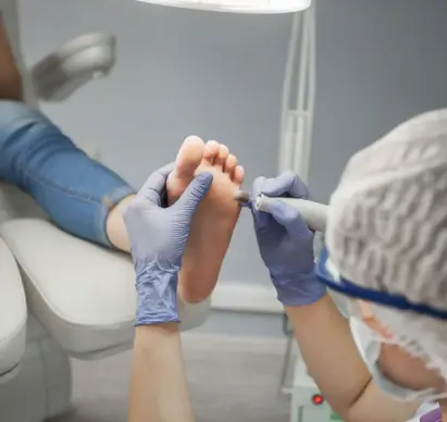tratamento de pés diabeticos em joinville santa catarina